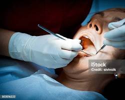 Hình ảnh về dentist examining a patient's teeth